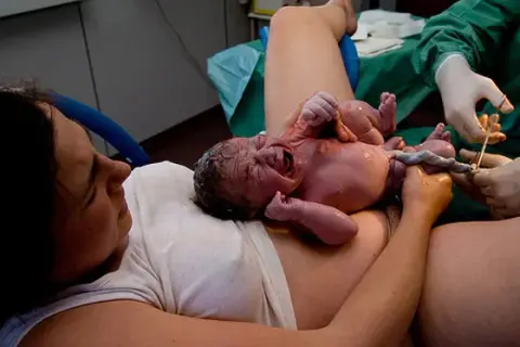 Czy pępowina rośnie wraz z rozwojem dziecka? Oto zaskakujące fakty