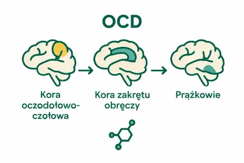 Schematyczne mózgi ilustrujące OCD po polsku: kora oczodołowo-czołowa, kora zakrętu obręczy i prążkowie.