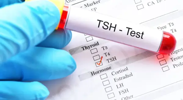 Rękawiczka trzyma probówkę z napisem "TSH - Test". Obok zaznaczono TSH na liście badań hormonalnych, co może być istotne w diagnostyce tsh w ciąży.
