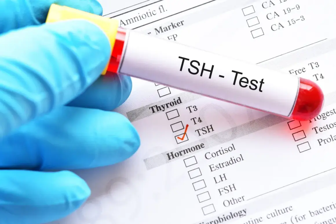 Rękawiczka trzyma probówkę z napisem "TSH - Test". Obok zaznaczono TSH na liście badań hormonalnych, co może być istotne w diagnostyce tsh w ciąży.