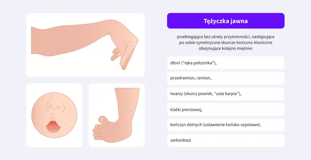 Ilustracje pokazują objawy tężyczki jawnej, np. 